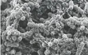Biofilm